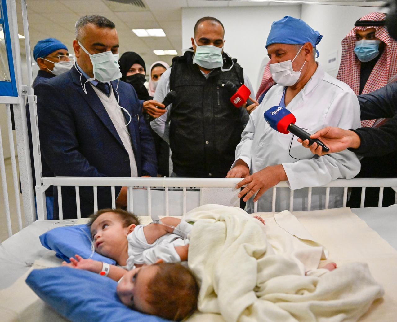 بدء عملية فصل التوأم السيامي العراقي "على وعمر"