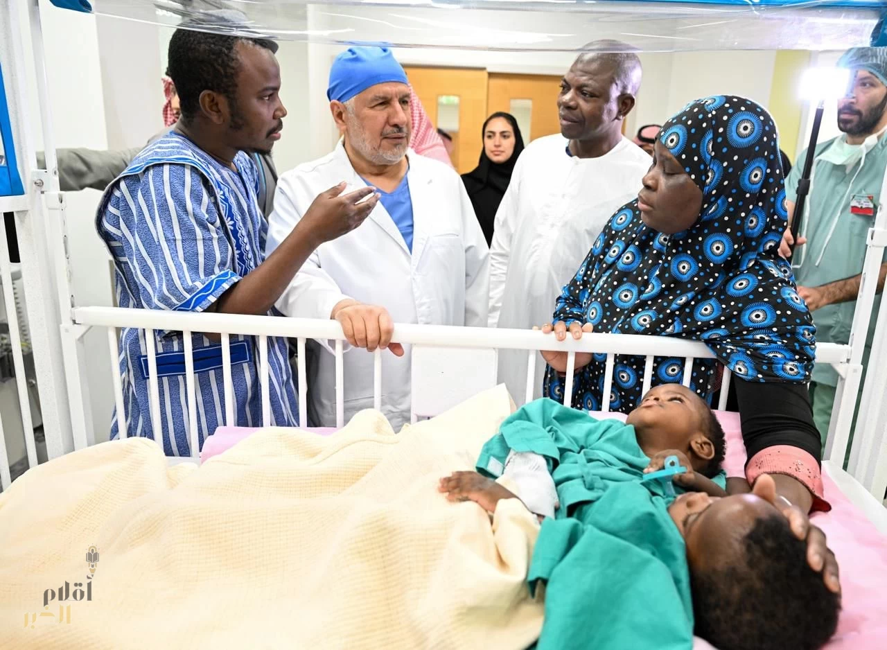 إنفاذًا لتوجيهات القيادة الرشيدة.. بدء عملية فصل التوأم السيامي البوركيني "حوى وخديجة"   
