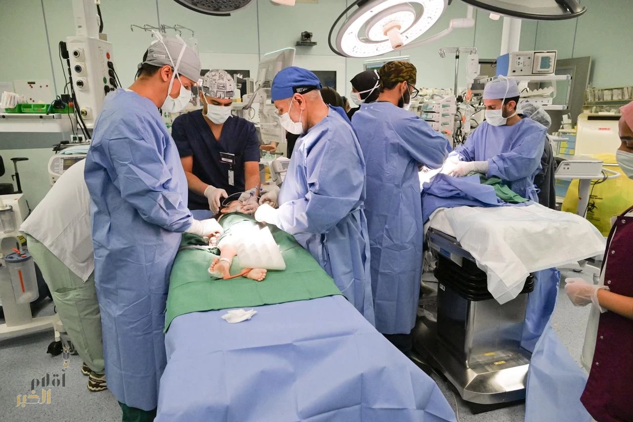 نجاح عملية فصل التوأم الملتصق السوري "سيلين وإيلين" بعد عملية جراحية معقدة استغرقت (8) ساعات
