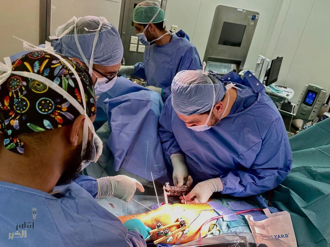 جراحة متقدمة تنهي معاناة مريضة عشرينية من تشوه عظم الفخذ بطبية مكة