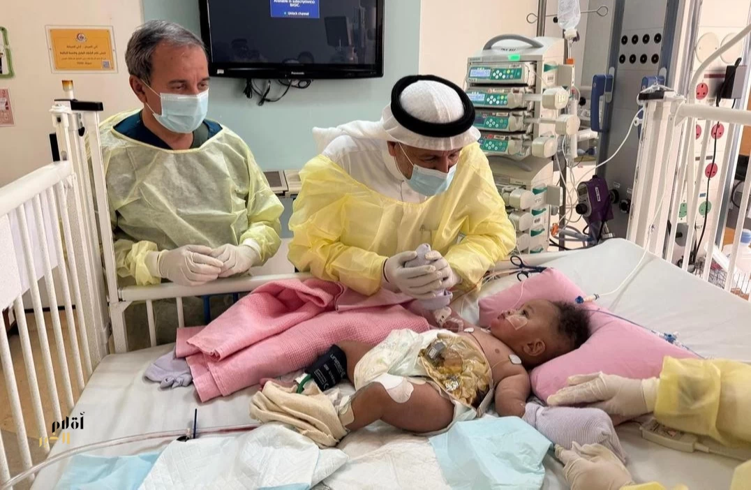 الدكتور الربيعة: استقرار حالة التوأم الصومالي "رحمة ورملا" بعد مرور أربعة أيام من عملية فصلهما الناجحة