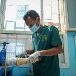مركز الأطراف الصناعية في مأرب يُقدّم خدماته لـ (7.677) مستفيدًا بدعم من مركز الملك سلمان للإغاثة