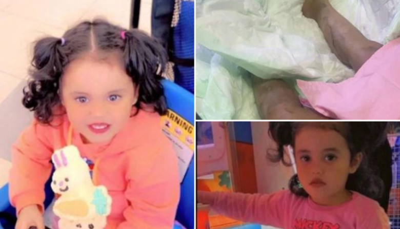 جريمة صادمة بجدة.. سكب الأسيد الحارق على زوجته وطفلته