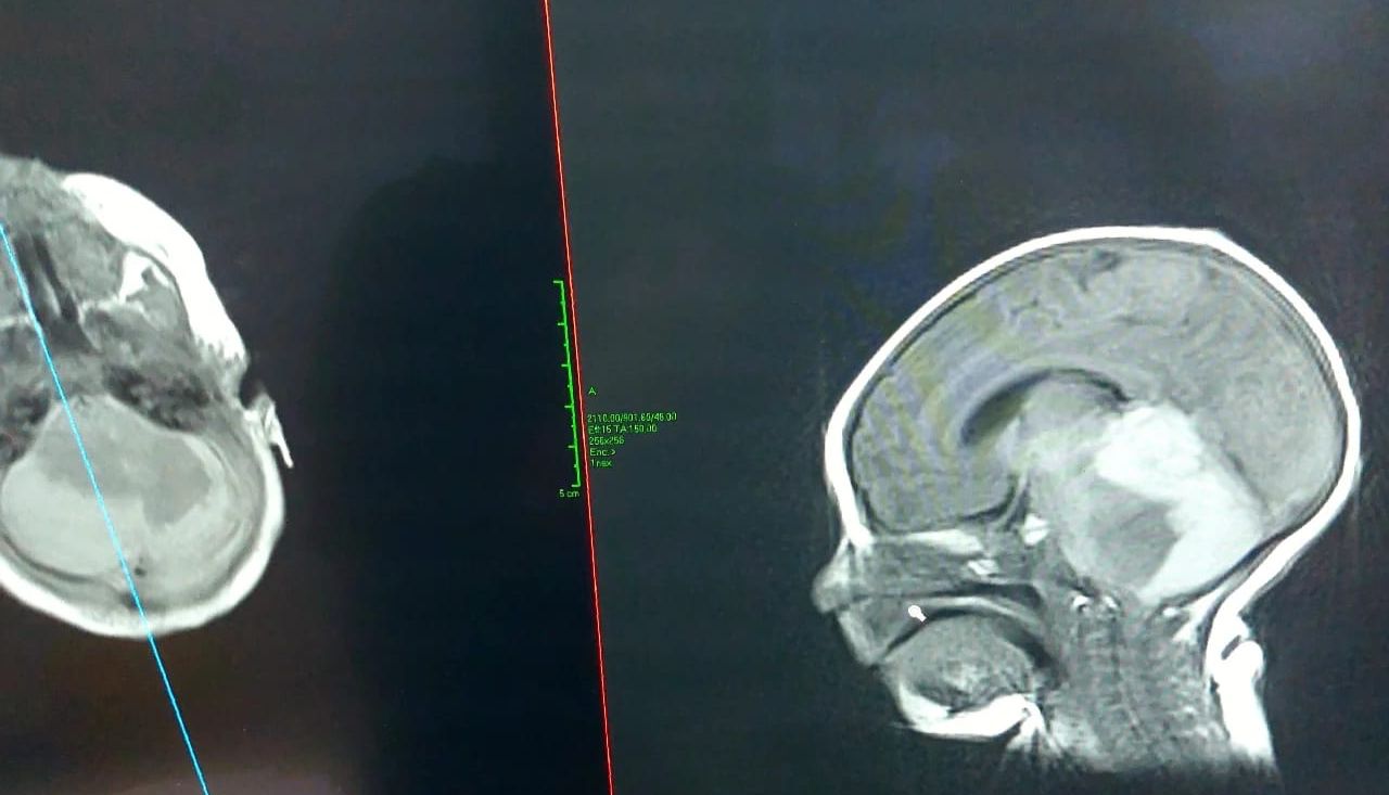 مسار الرعاية العاجلة في التجمع الأول ينقذ مولودة بمستشفى الملك خالد بالخرج