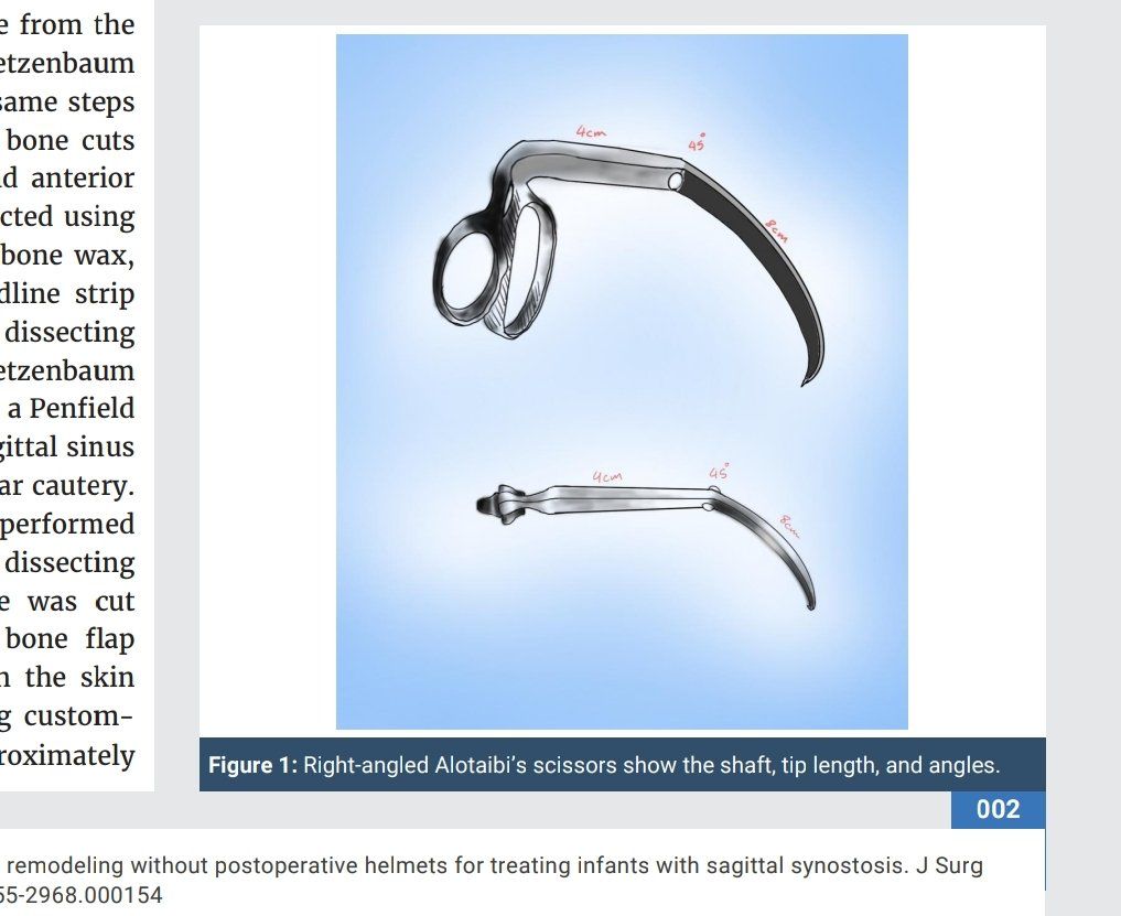 في "فهد الطبية".. طبيب يبتكر تقنية لتصحيح التعظم المبكر للجمجمة لدى الأطفال