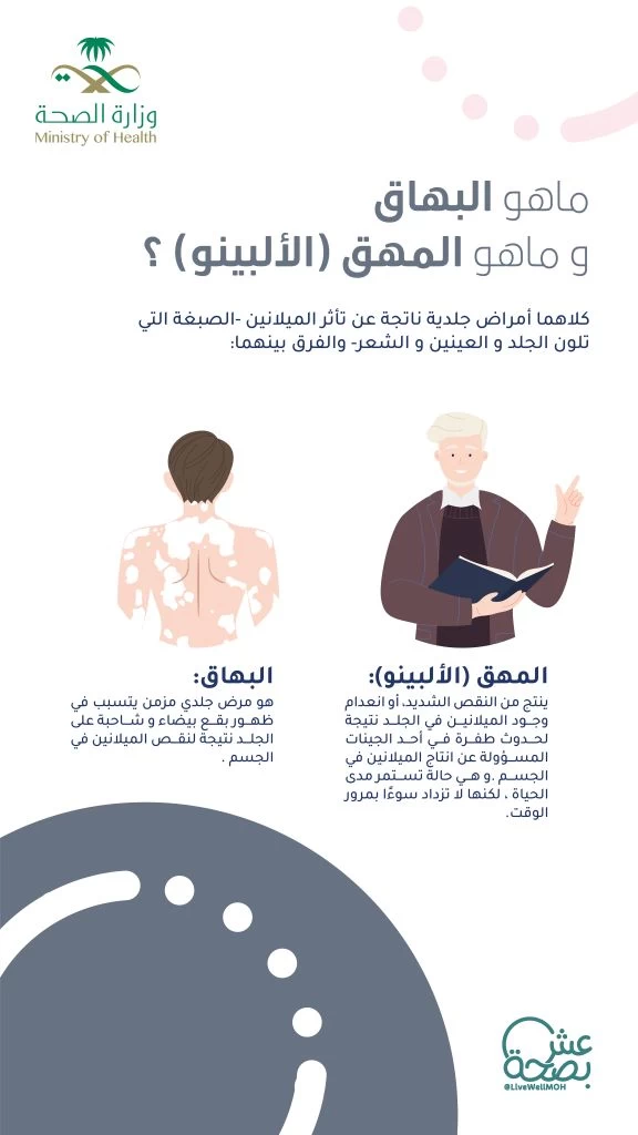 مستشفى الملك فهد يدشن حملة " يوليو التوعوي " 