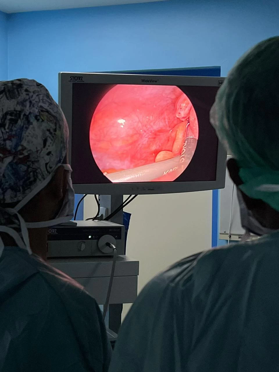 استئصال زائدة بالمنظار في مستشفى رماح العام