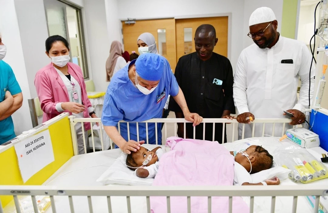 إنفاذًا لتوجيهات القيادة : بدء عملية فصل التوأم السيامي النيجيري