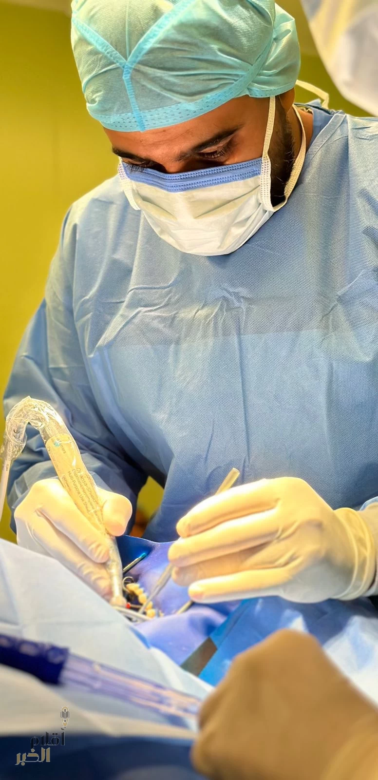 فريق جراحة الوجه والفكين بمستشفى صبيا ينجح في استئصال كيس كيراتيني سني وتجميل وجه وفم أربعيني
