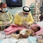 الدكتور الربيعة: استقرار حالة التوأم الصومالي "رحمة ورملا" بعد مرور أربعة أيام من عملية فصلهما الناجحة