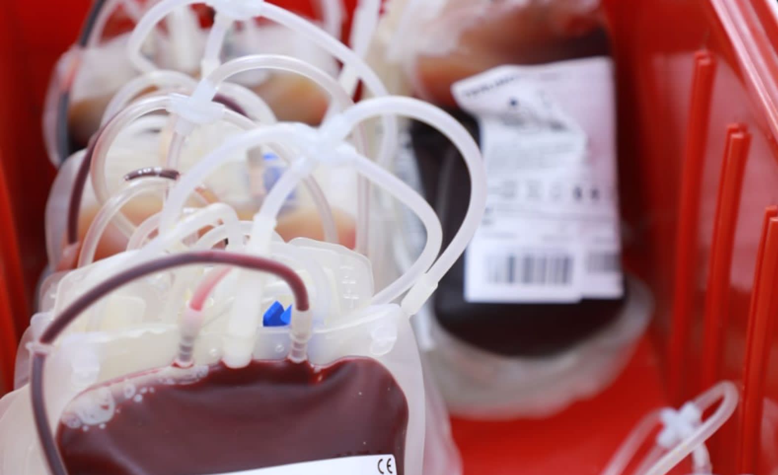 جمع 6337 وحدة دم عبر 60 حمله خلال 5 أشهر  تخصصي الدمام ينفذ حملات "شهريه" للتبرع بالدم لخدمة المرضى