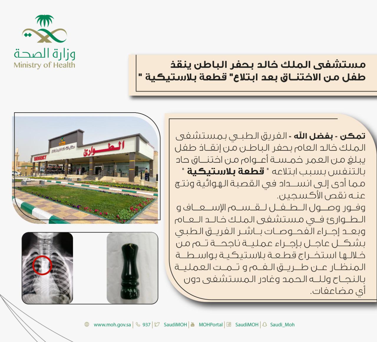 مستشفى الملك خالد بحفر الباطن ينقذ طفل من الاختناق بعد ابتلاع قطعة بلاستيكية
