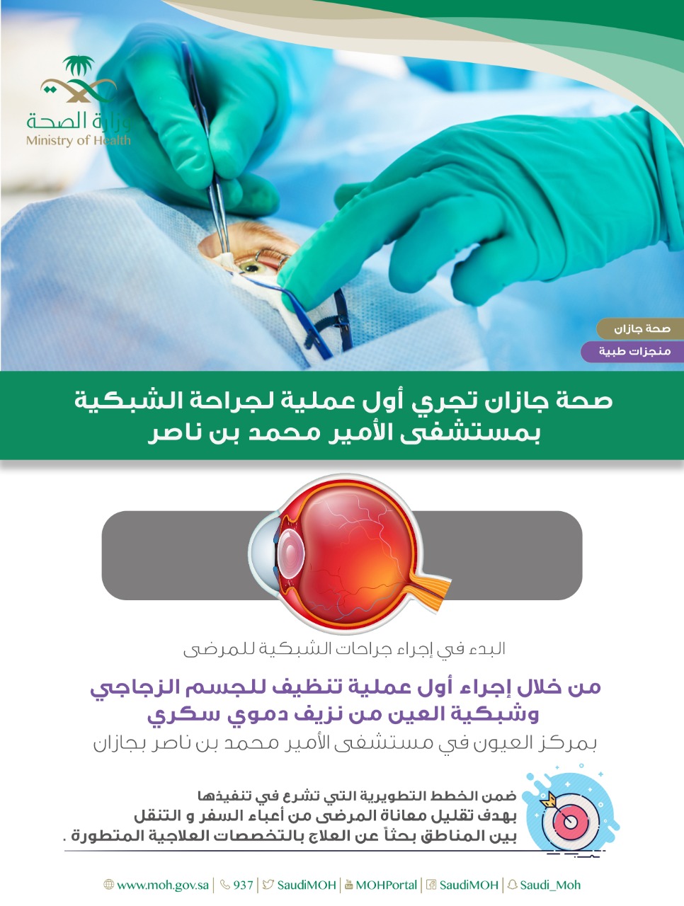 بدء إجراء جراحات الشبكيةبمستشفى الأمير محمد بن ناصر بجازان