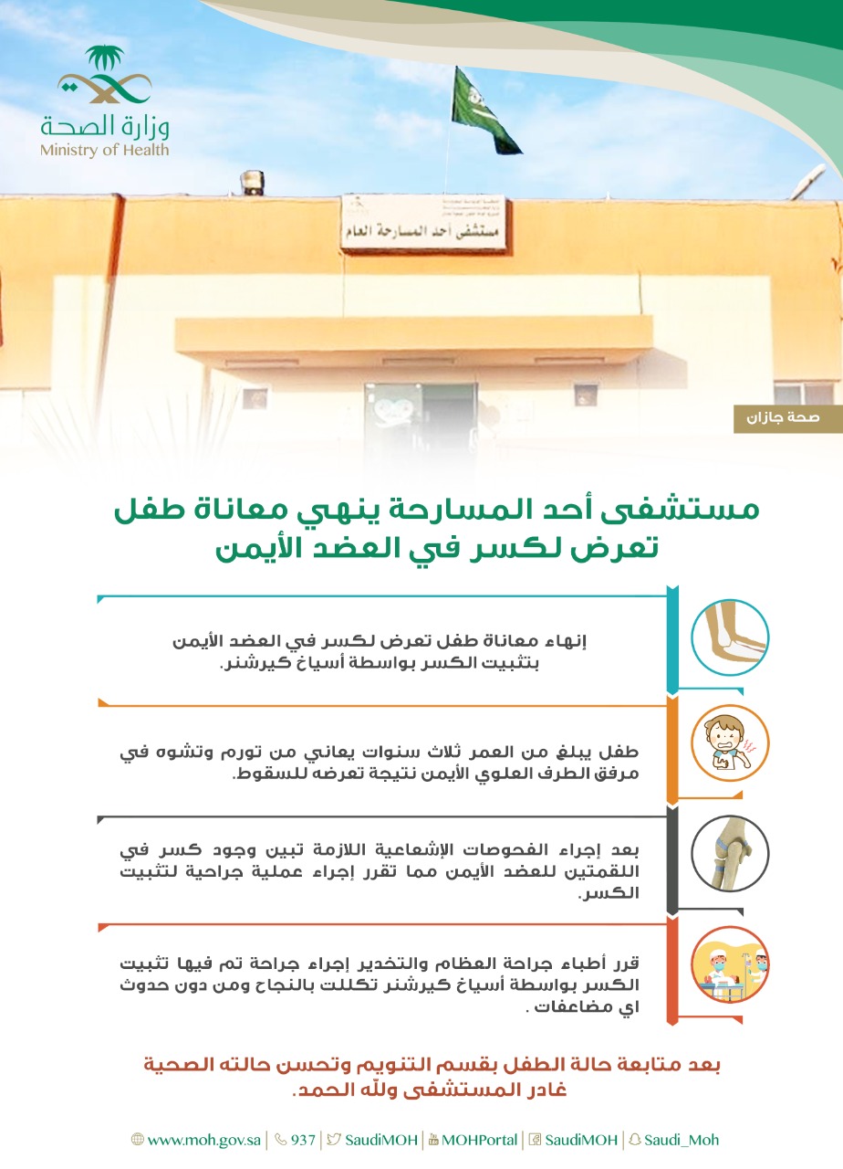 مستشفى أحد المسارحة ينهي معاناة طفل تعرض لكسر في العضد الأيمن