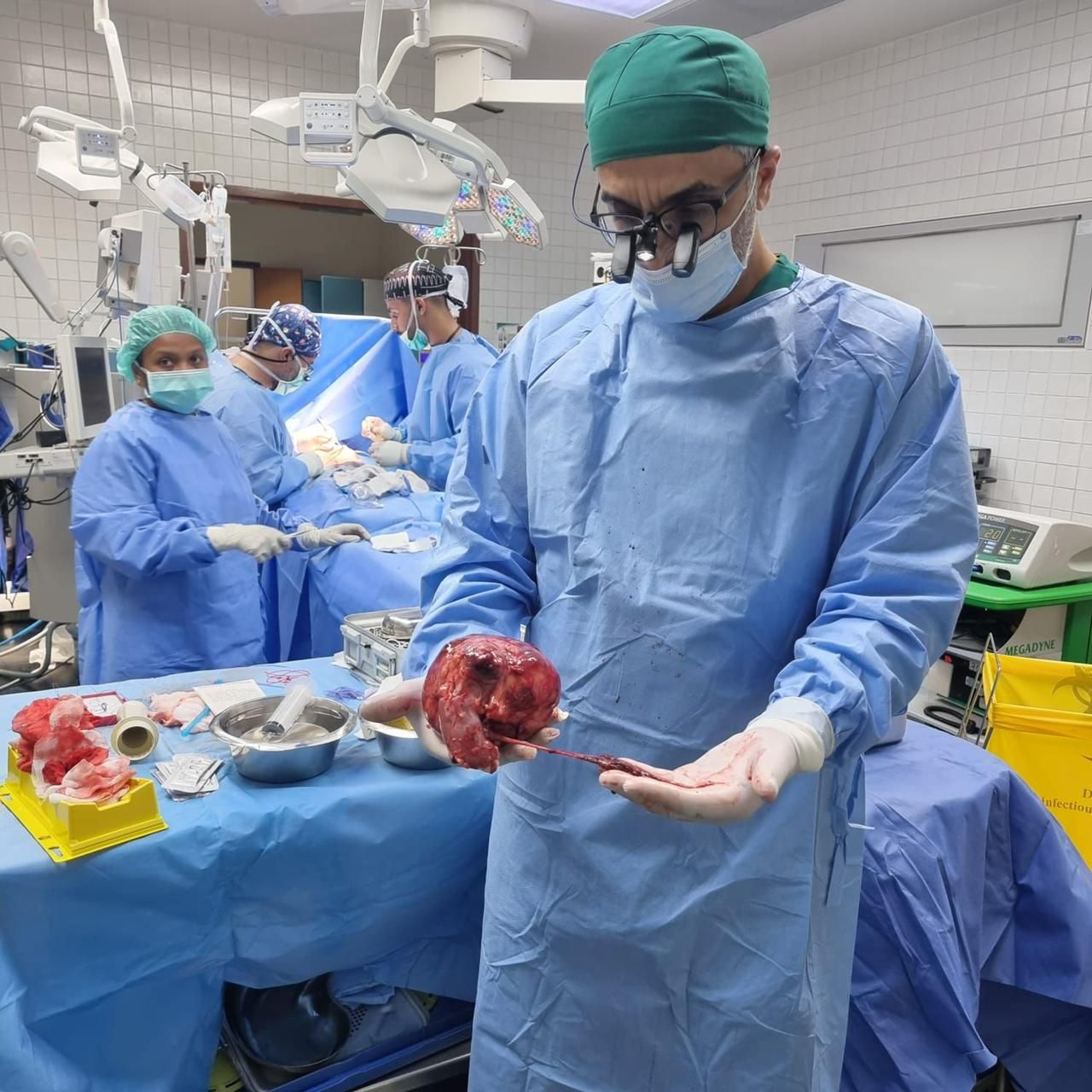 فريق طبي في مستشفى الملك سلمان ينهي معاناة طفل من ورم في البطن